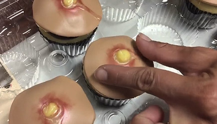 Dr. PimplePopper Cupcakes